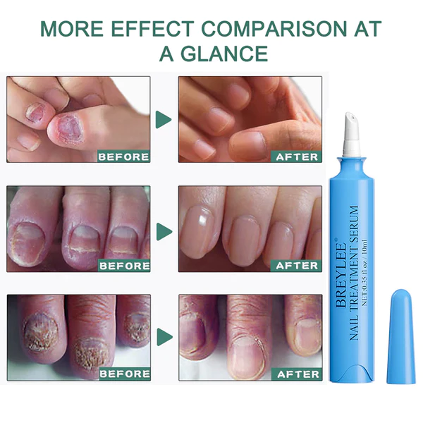Nail Treatment Serum Pen - Image 5