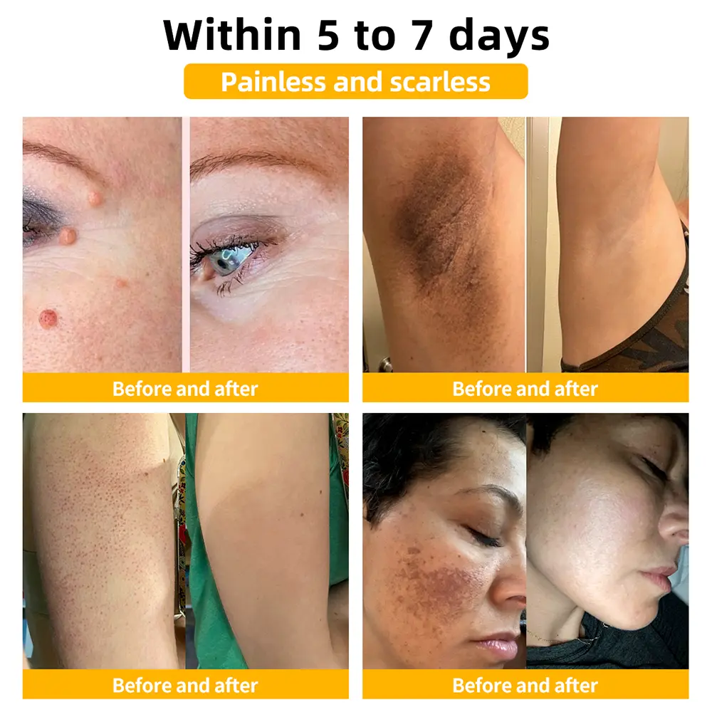 Bee Venom Skin Treatment Cream - Image 2