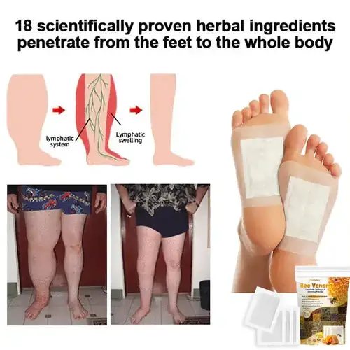 Bee Venom Lymphatic Drainage & Slimming Patches - Image 5