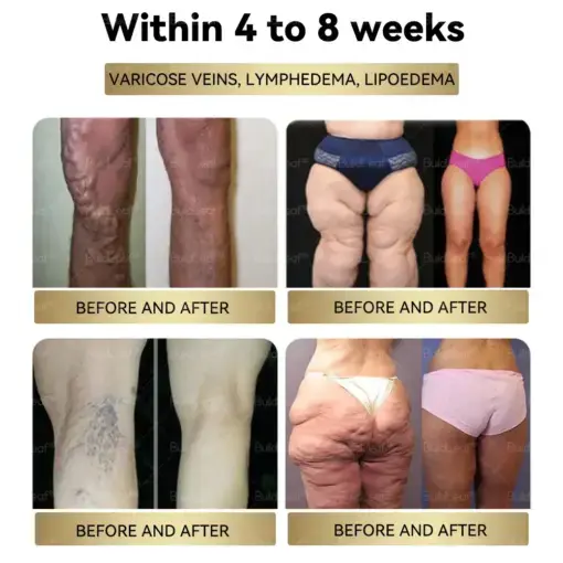 Moringa Slimming & Health Boost Drops - Image 5