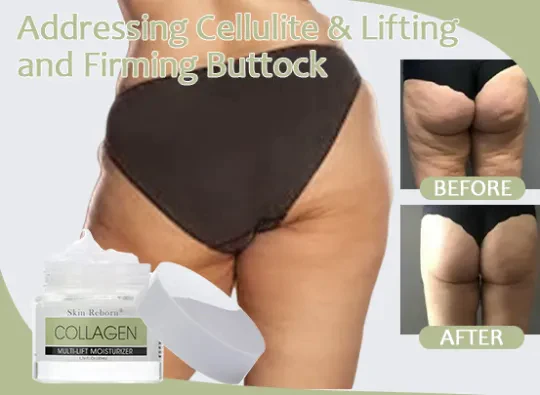 West&Month REBORN SKIN COLLAGEN BOOST FAST FIRMING AND LIFTING CREAM - Image 5