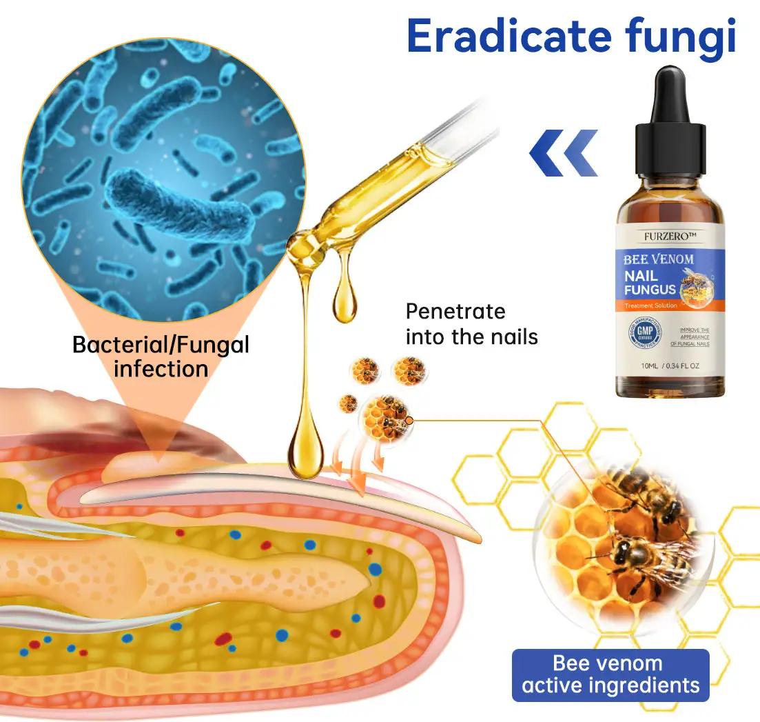 Bee Venom Nail Fungus Treatment Cream - Image 3