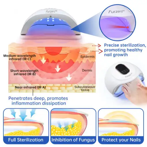 Advanced PureNail Fungus Laser Device - Image 2