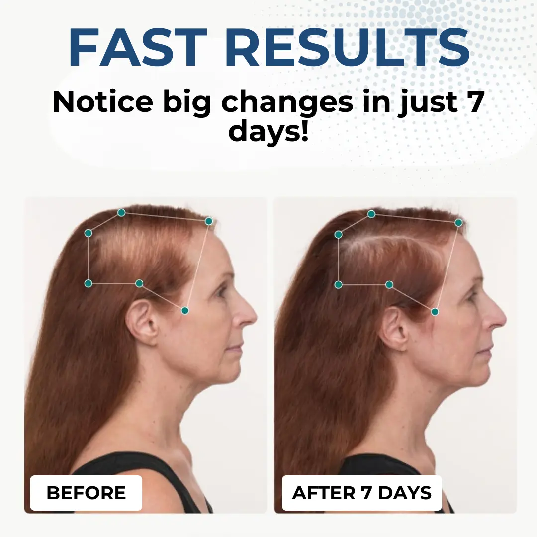 Hair Regrowth Capsules - Image 2
