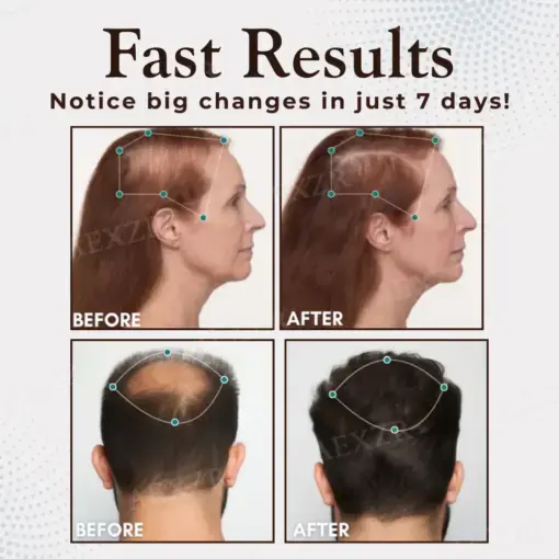 Hair Regrowth Capsules Revive Follicles - Image 2