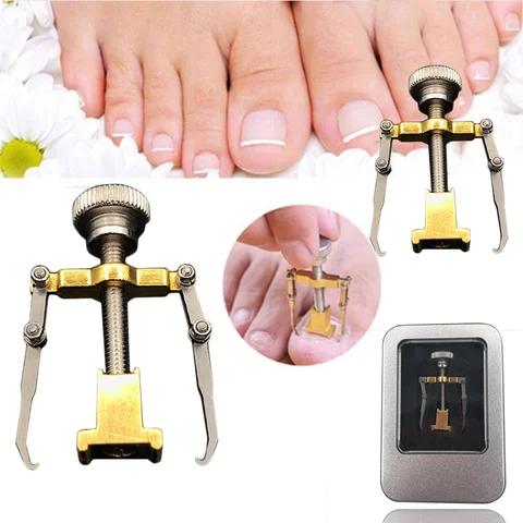 Ingrown Out - Image 2