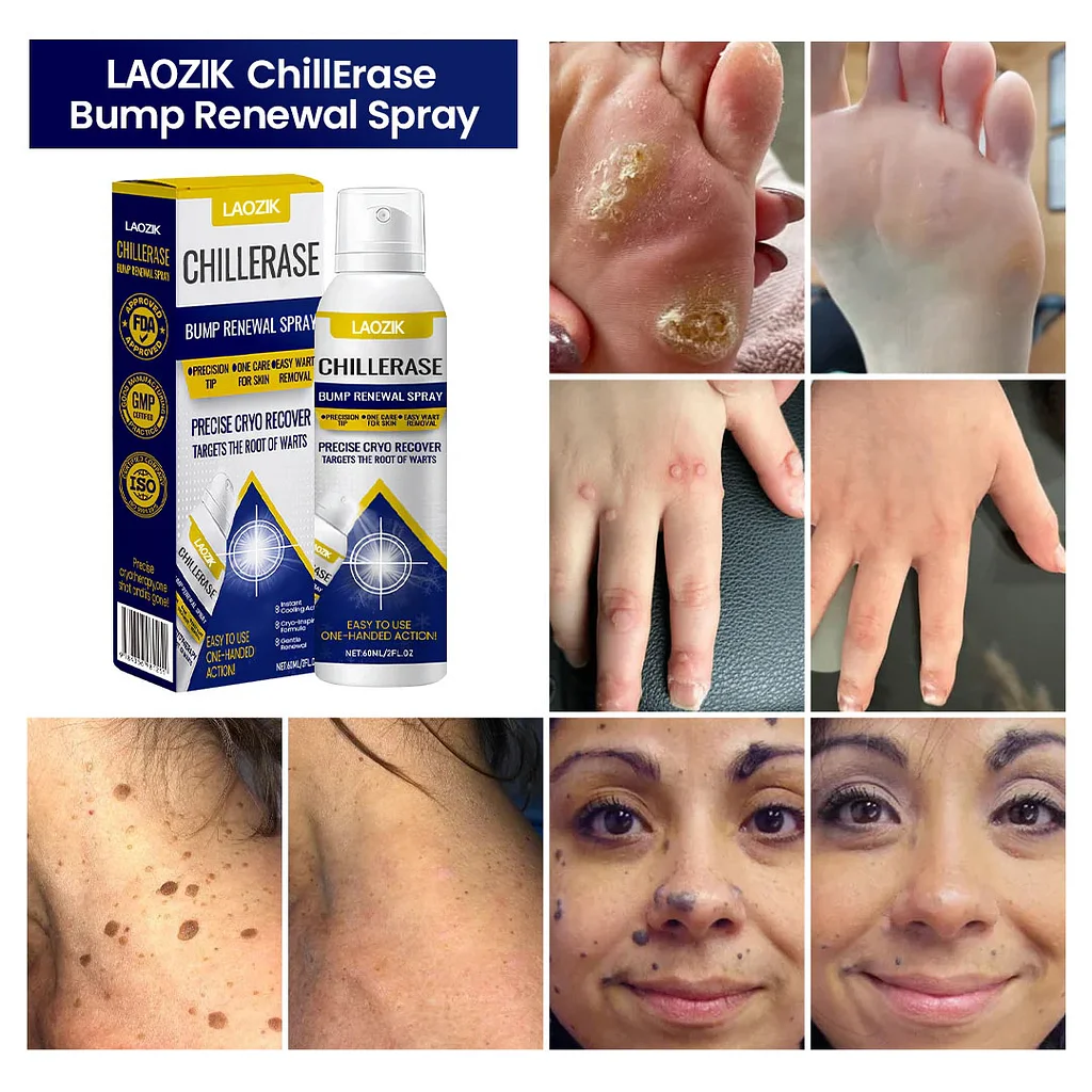 LAOZIK ChillErase Bump Renewal Spray - Image 3