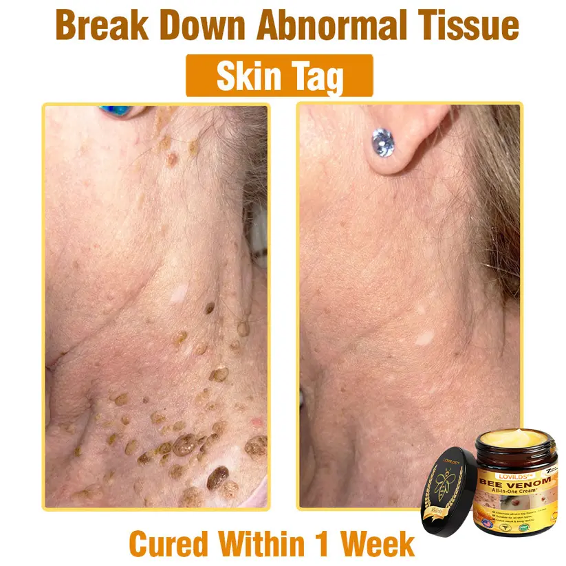 Bee Venom All-in-One Cream - Image 11