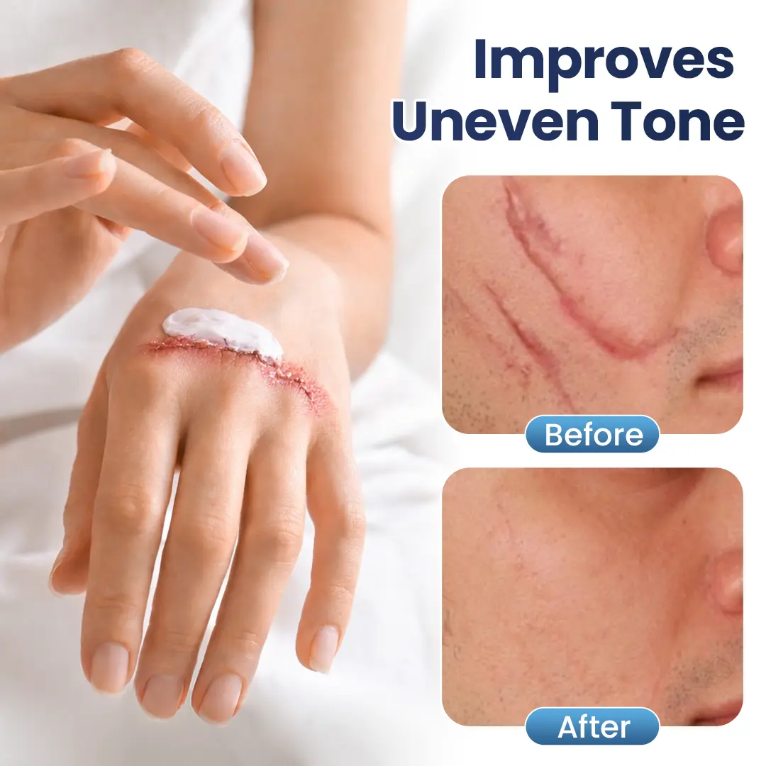 Texture Repair Gel - Image 3