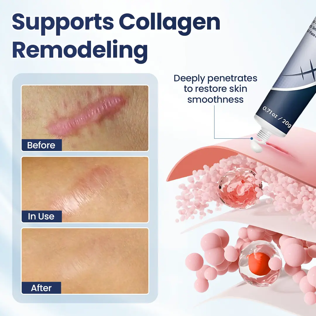 Texture Repair Gel - Image 6