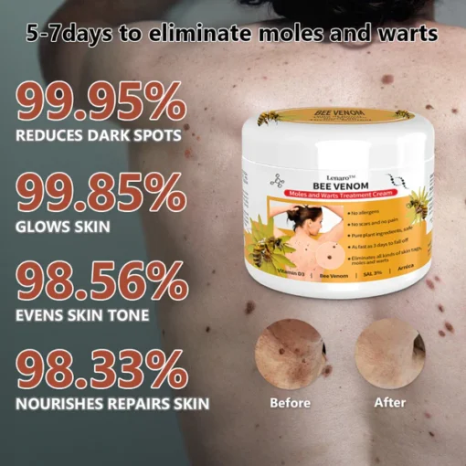 Bee Venom Mole and Wart Treatment Cream - Image 6