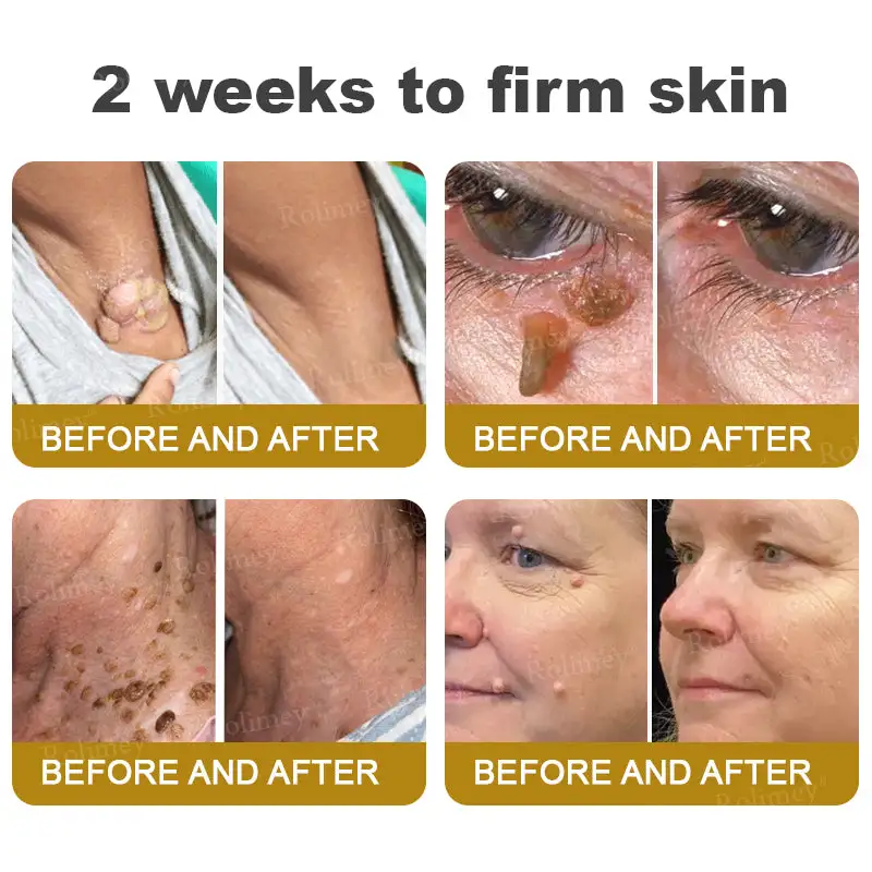 Bee Venom Skin Comprehensive Cream - Image 4