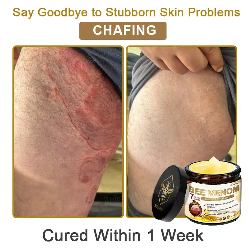 Bee Venom Skin Comprehensive Cream - Image 7