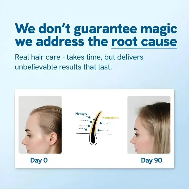 NESLEMY Advanced Hair Growth Roll‑On - Image 3
