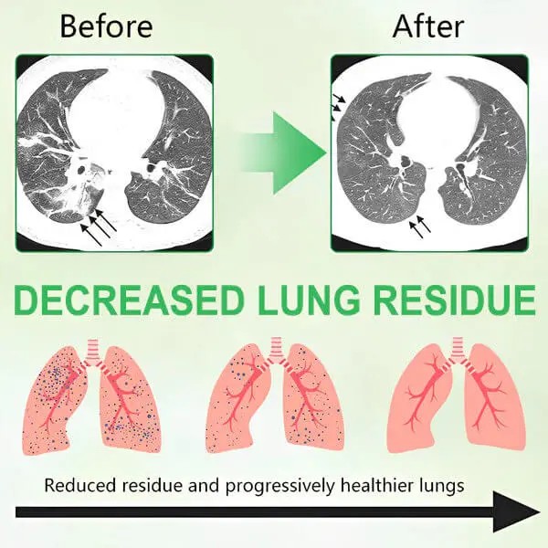 3X Concentrated Mullein Lung Cleanse Spray - Image 3