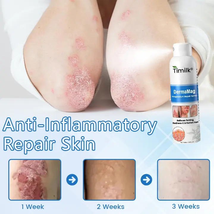 ✅ Official Store: DermaMag Magnesium Repair Spray 🔥 - Image 7