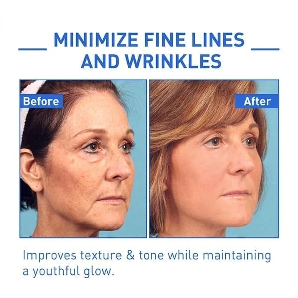 Oveallgo ™ Youthfully Botox Face Serum - Image 3