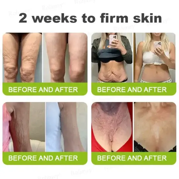 Botox & Vita-A Retinol Shot - Image 9