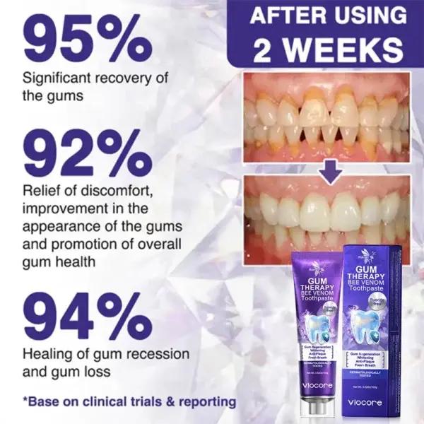 VioCore Bee Venom Dental Treatment Toothpaste - Image 2