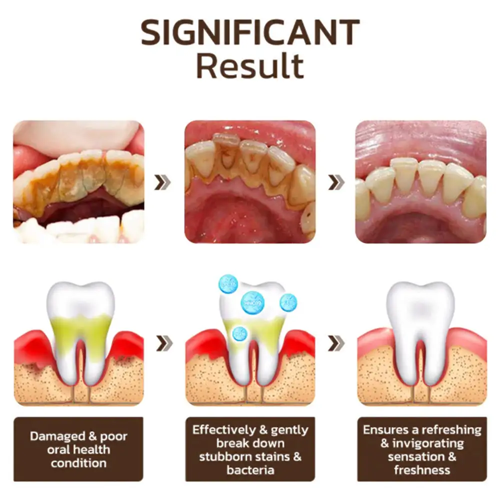 Niacinamide Whitening Toothpaste - Image 5