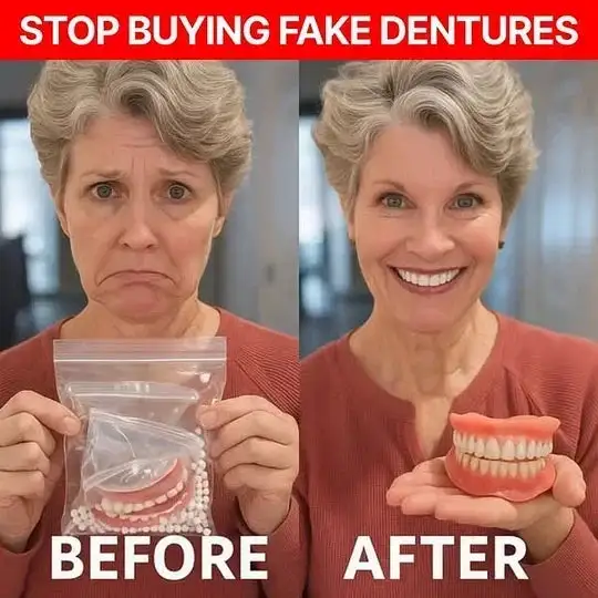 Custom-Fit Functional Dentures - Image 5