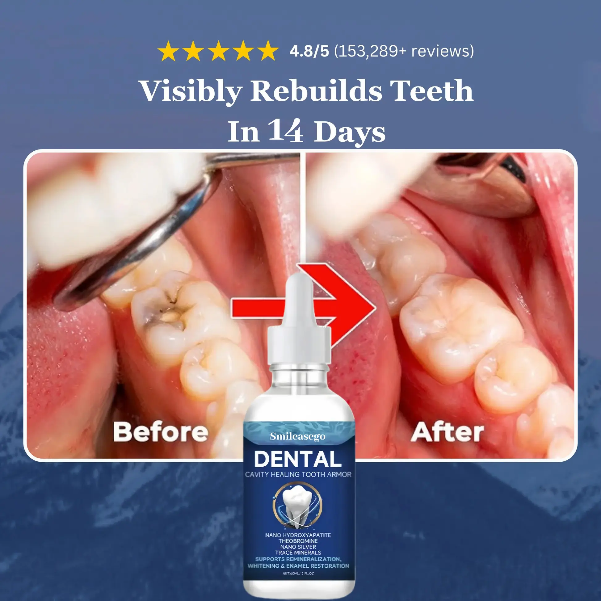 Smileasego Fluoride-Free Hydroxyapatite Tooth Armor Drops & Enamel Repair, Whitening - Image 2