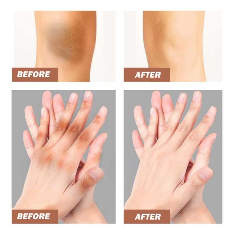 The Most Popular Whitening Cream - Image 5