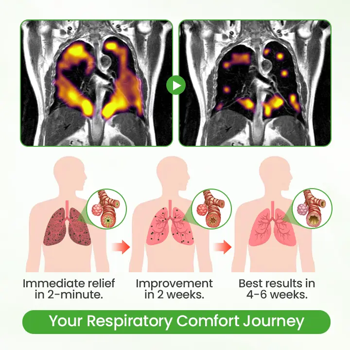 HerbaAir Mullein Lung Purifier - Image 4