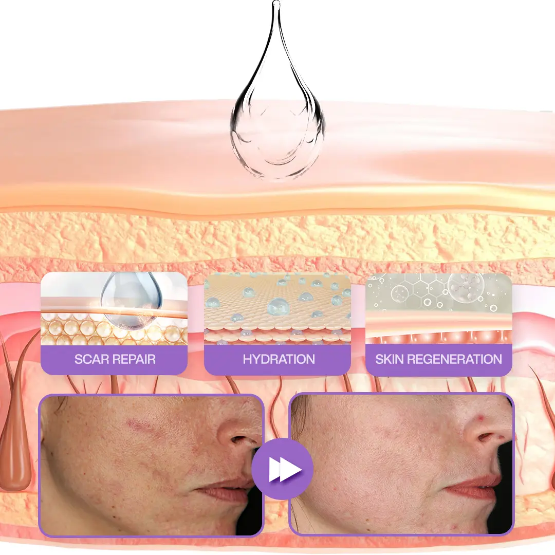 RevivaDerma Face & Body Scar Gel - Image 11