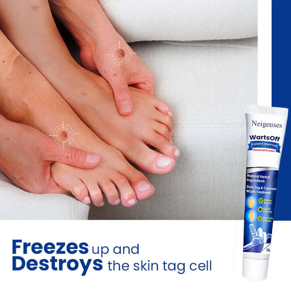 WartsOff Instant Blemish Removal Cream - Image 4