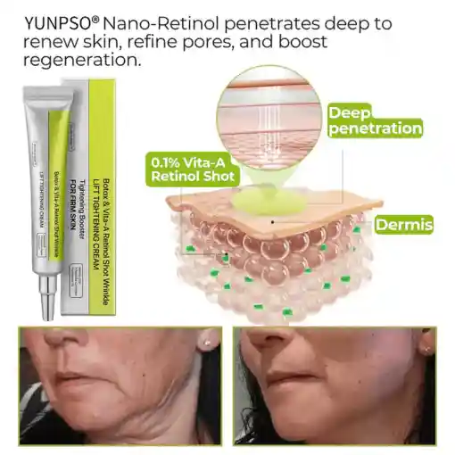 Botox & Vita-A Retinol Shot Wrinkle-Lift Tightening cream