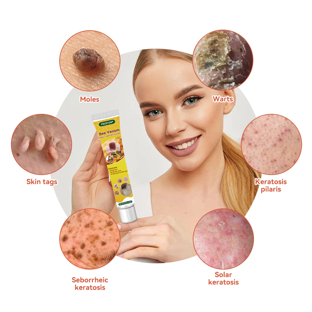 𝐁𝐞𝐞 𝐕𝐞𝐧𝐨𝐦 𝐖𝐚𝐫𝐭 𝐓𝐫𝐞𝐚𝐭𝐦𝐞𝐧𝐭 𝐂𝐫𝐞𝐚𝐦 - Image 7