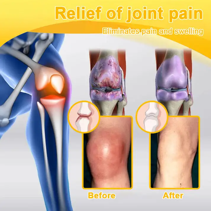 Winter Sale Botulinum Toxin and Bee Venom Pain Relief Bone Healing Cream - Image 10