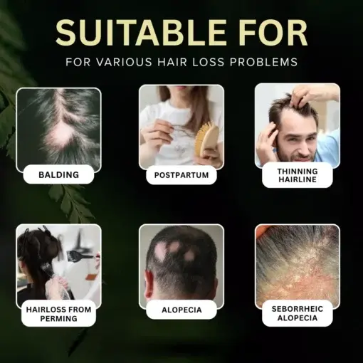 Clinical Exosome Therapy Shampoo Bio-Signal Hair Regrowth System - Image 2