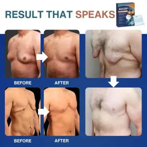 Nano-Microneedle Chest-Sculpt Bio-Patch (๐๐ฎ๐ฌ๐ญ ๐จ๐ง๐๐ ๐ ๐๐๐ฒ, ๐ฏ๐ข๐ฌ๐ข๐๐ฅ๐ ๐๐ก๐๐ง๐ ๐๐ฌ ๐ข๐ง ๐ ๐ซ๐๐ฒ๐ฌ ๐
๐จ๐ซ ๐๐ฒ๐ง๐๐๐จ๐ฆ๐๐ฌ๐ญ๐ข๐, ๐๐ฑ๐๐๐ฌ๐ฌ ๐๐ก๐๐ฌ๐ญ ๐
๐๐ญ, ๐๐๐ ๐ ๐ข๐ง๐ ๐๐ค๐ข๐ง, ๐๐๐๐๐ ๐ฆ๐๐๐ก, ๐๐ง๐ ๐ฆ๐จ๐ซ๐ - Image 3