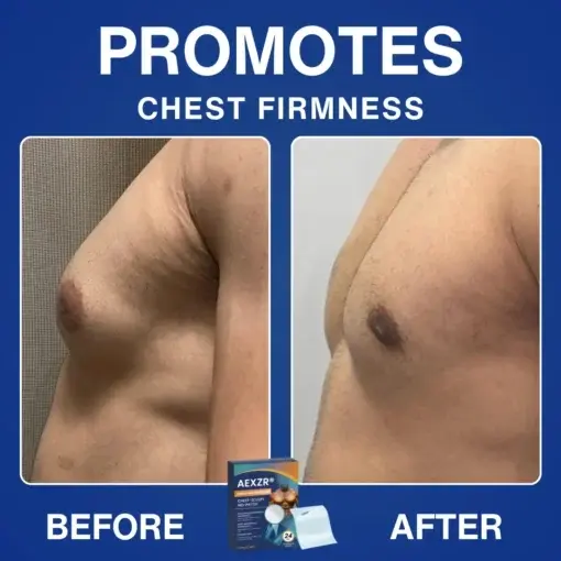 Nano-Microneedle Chest-Sculpt Bio-Patch (๐๐ฎ๐ฌ๐ญ ๐จ๐ง๐๐ ๐ ๐๐๐ฒ, ๐ฏ๐ข๐ฌ๐ข๐๐ฅ๐ ๐๐ก๐๐ง๐ ๐๐ฌ ๐ข๐ง ๐ ๐ซ๐๐ฒ๐ฌ ๐
๐จ๐ซ ๐๐ฒ๐ง๐๐๐จ๐ฆ๐๐ฌ๐ญ๐ข๐, ๐๐ฑ๐๐๐ฌ๐ฌ ๐๐ก๐๐ฌ๐ญ ๐
๐๐ญ, ๐๐๐ ๐ ๐ข๐ง๐ ๐๐ค๐ข๐ง, ๐๐๐๐๐ ๐ฆ๐๐๐ก, ๐๐ง๐ ๐ฆ๐จ๐ซ๐ - Image 5