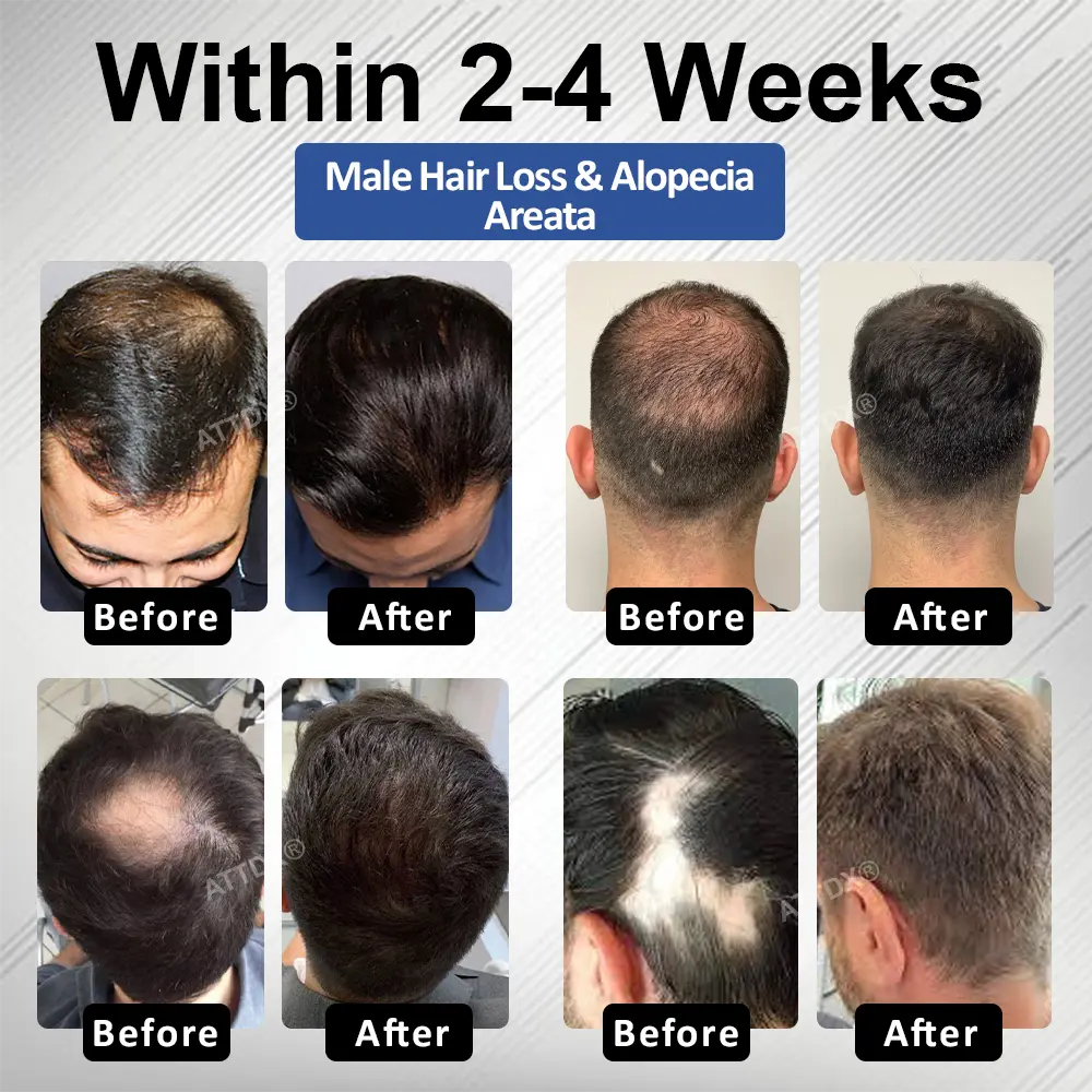PP405 FolliGen Re-Awaken Hair Spray - Image 3