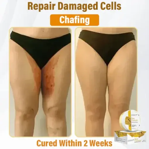 Bee Venom Skin Renewal Cream - Image 5