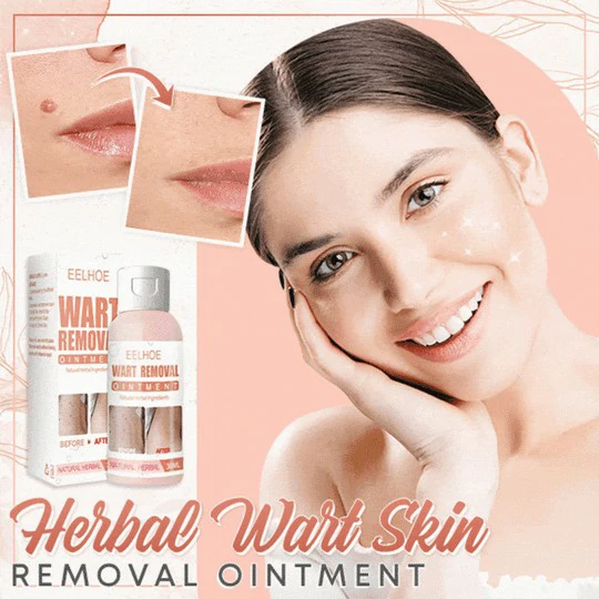 Herbal Wart Skin Removal Ointment - Image 2