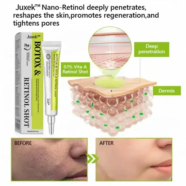 Botox & Retinol Shot - Image 8