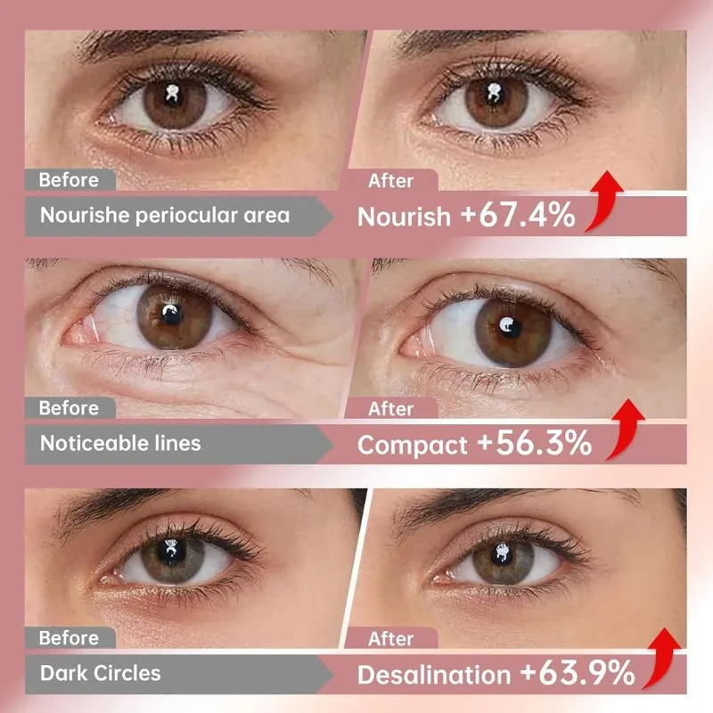 Collagen Peptide Lifting Eye Masks - Image 2