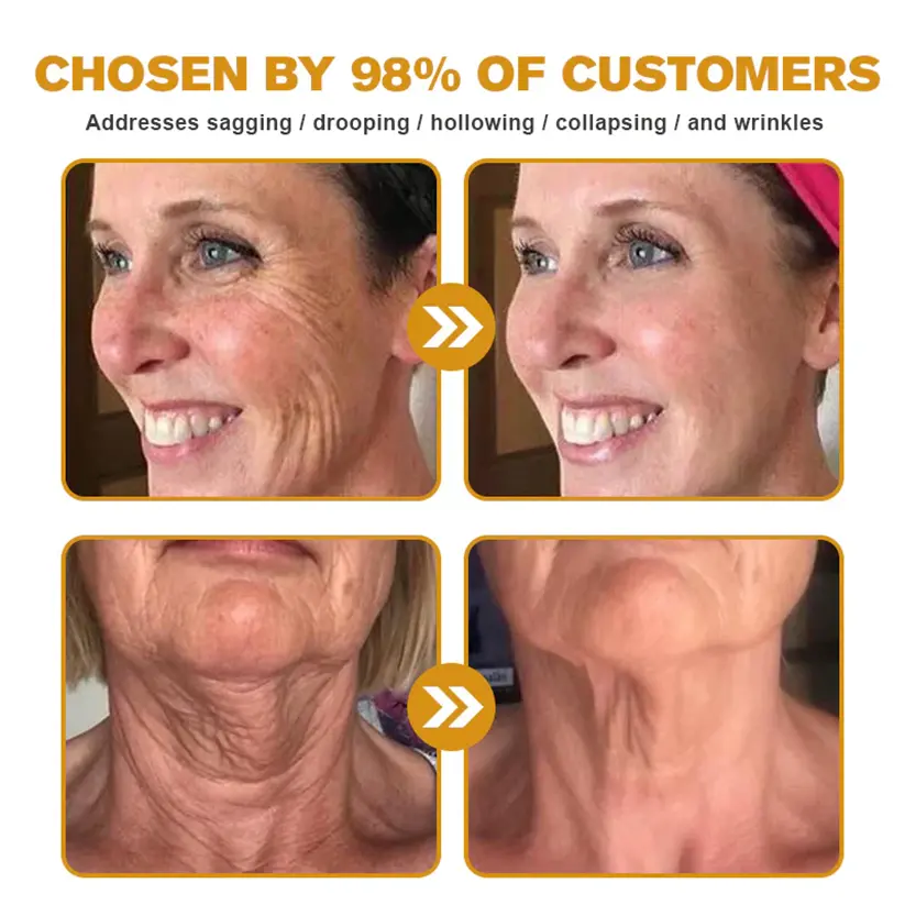 Bee Venom Skin Restoration Cream - Image 5