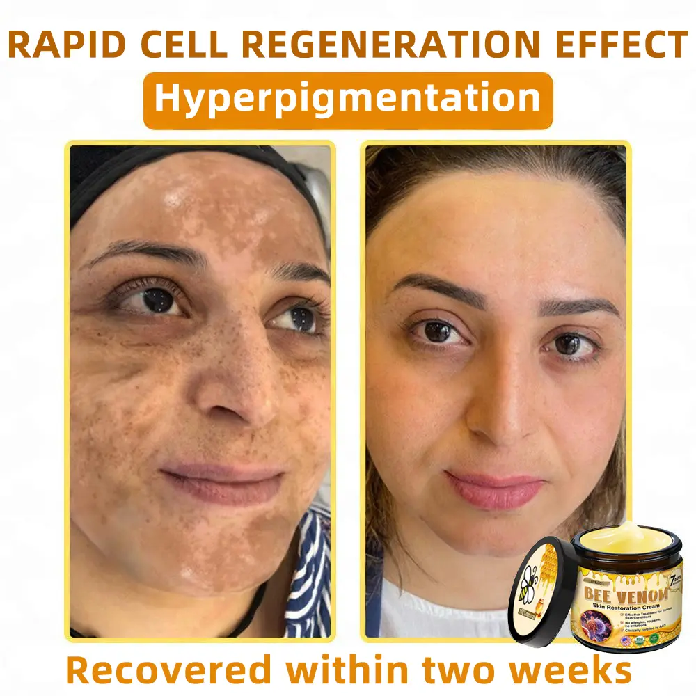 Bee Venom Skin Restoration Cream - Image 8