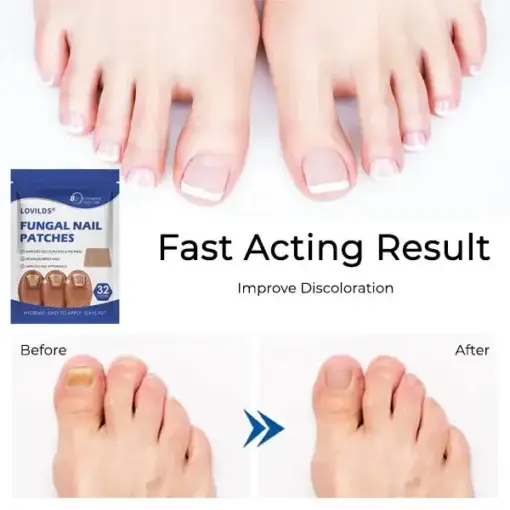 FUNGAL NAIL PATCHES - Image 4
