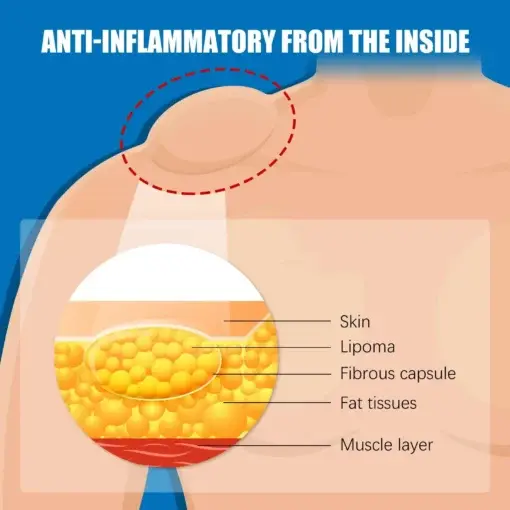 LIPOMA CREAM - Image 5