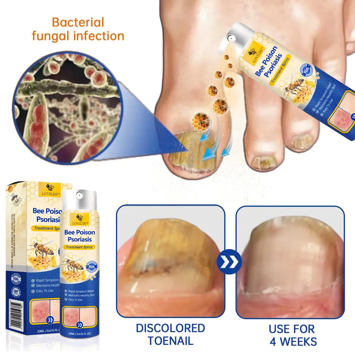 PsoriaHeal psoriasis Spray pro - Image 7