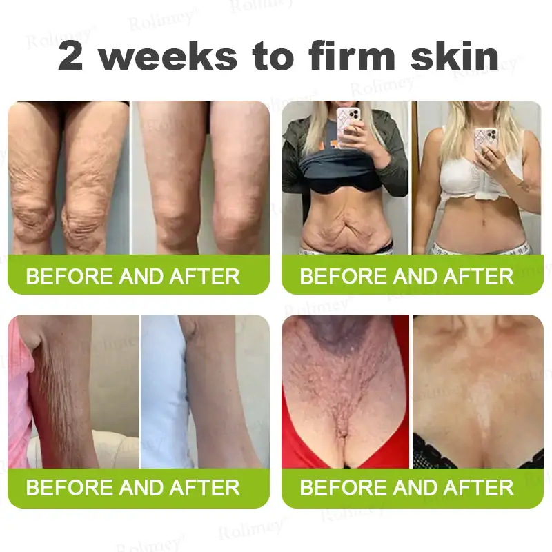 Botox & Retinol Shot - Image 4