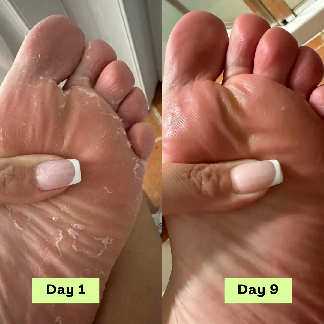 55% off AntiFungal Relief Soap Bar - Image 5