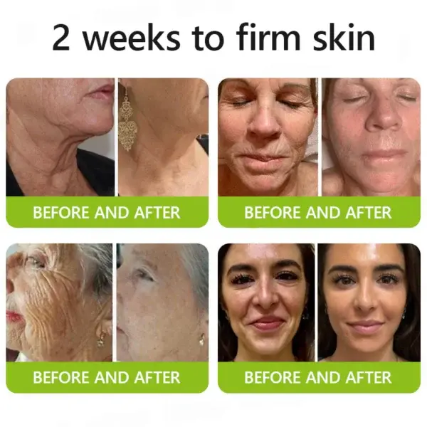 Botox & Retinol Shot - Image 15