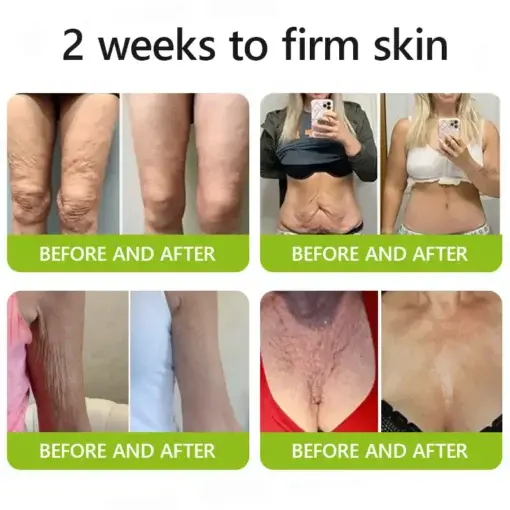 Botox Retinol Shot , FDA-Compliant Formula to Firm Sagging Skin Reduce Puffy Eyes - Image 6